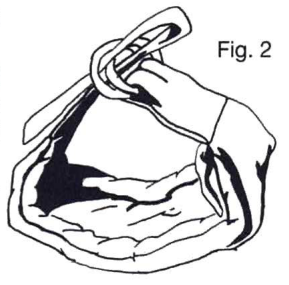 Fig. 2 - chiusura con anelli